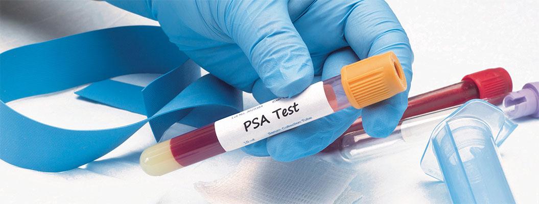 PSA Level Testing